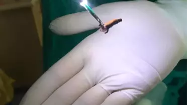 Çiğnediği karanfil akciğerine kaçınca ölümden döndü