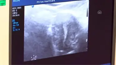 Çocuk sahibi olamayan kadınlar için 'kök hücre uygulaması' tanıtıldı