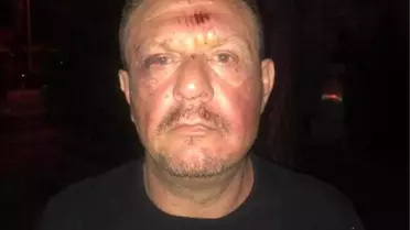 Denizlispor Başkanı Çetin'in Fethiye'de darbedildiği iddiasına ilişkin iddianame hazırlandı