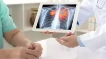 35.000 kişi Dünyada bu vakaya yakalanıyor!