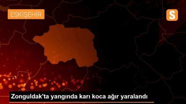 Zonguldak'ta yangında karı koca ağır yaralandı