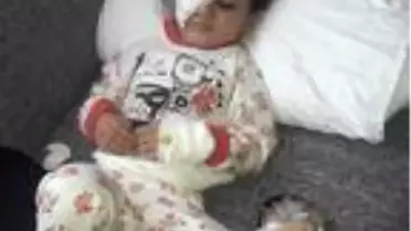 Minik Ünzile için 45 bin liraya ihtiyaç var