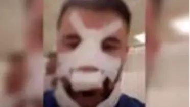 Bayram günü sağlık çalışanını darbeden şüpheli tutuklandı