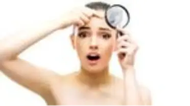 Sivilce mi akne mi? Dermatolog Dr. Neslihan Dolar yazdı