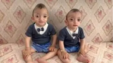 Hasta ikiz çocuklar yardım bekliyor