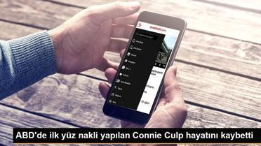 ABD'de ilk yüz nakli yapılan Connie Culp hayatını kaybetti