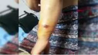 GAZİANTEP Eşinin çocuklarının gözü önünde dövdüğü Fatma, koruma altına alındı