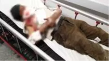 Misafirliğe gittiği evin köpeği yaşlı adamın önce yüzünü, sonra vücudunu parçaladı