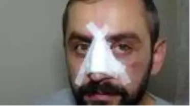 DHA muhabirine çirkin saldırı; kısıtlamayı ihlal eden boksör, gazetecinin burnunu kırdı (3)