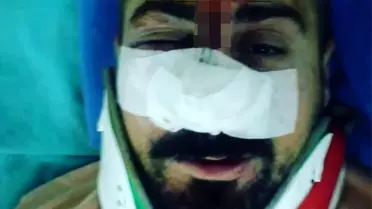 Kiraz toplamak için çıktığı ağaç canından ediyordu