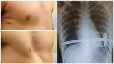 Bu hastalık çocukları yaz tatiline küstürüyor