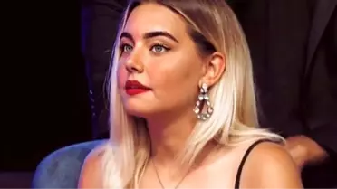 Survivor'un sevilen ismi estetik yaptırdı! Son hali şoke etti