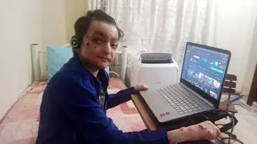 Kelebek hastası genç hayallerinin peşinde