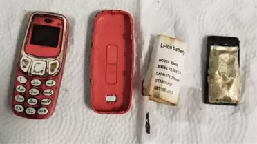 Kosova'da akılalmaz olay! 33 yaşındaki bir hastanın midesinden Nokia 3310 çıktı