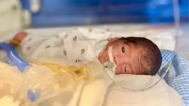 648 GRAM DOĞAN UMUT BEBEK HAYATA TUTUNMAYI BAŞARDI