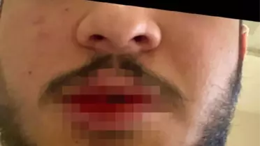 Kars'ta sağlık çalışanı darp edildi