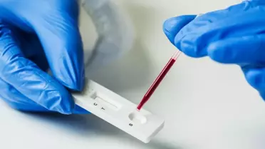 Türk bilim insanları 48 farklı antikor test kitini değerlendirdi