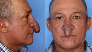 Burnu cinsel organa benzeyen adam, sosyal medyada gündeme oturdu