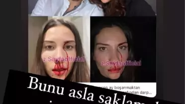 Futbolcu Özer Hurmacı eşini darp etti iddiası