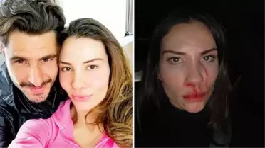 Eşi Özer Hurmacı'dan şiddet gören Mihriban Hurmacı, korku dolu o anları anlattı: Çocuklar, bana tekme atan babalarının bacağına sarıldı
