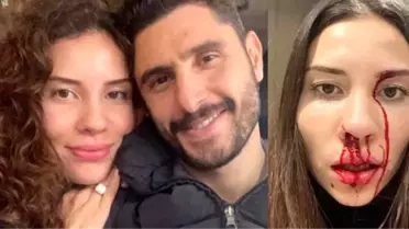 Eşini dövdüğü iddia edilen Özer Hurmacı sessizliğini bozdu: Gerçeği yansıtmıyor