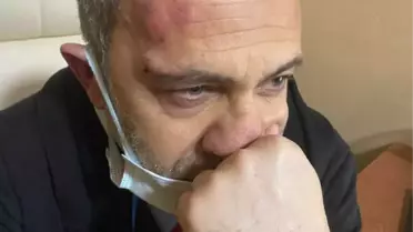 Hasta yakınları hemşireyi darbetti: 3 gözaltı