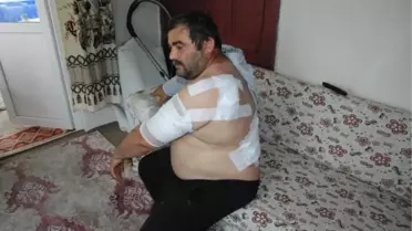 Ayının saldırdığı işçi: Öldüğümü sanıp bıraktı