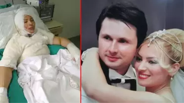 Boşandığı eşi tarafından ateşe verilen Elvan Sözkesen yaşadıklarını anlattı: Mangal yanıyormuş gibi canice izledi