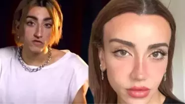 Estetik Operasyon Geçirdi! Son Hali Şoke Etti