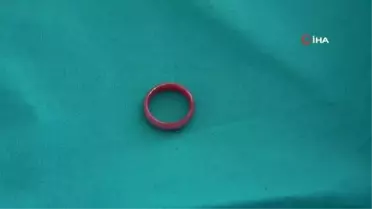 Yüzük yutan 3 yaşındaki çocuk ölümden döndü