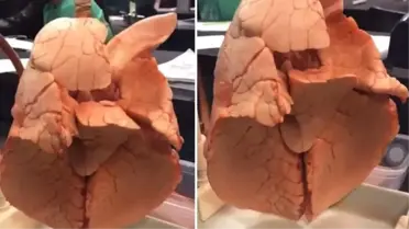 Sigara bağımlısının akciğer görüntüsü korkuttu! Farkı gören bırakabilir