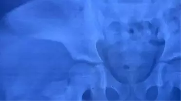 Küçük çocuğun cinsel organı için ultrasonun isteyen doktorlar, görülmemiş bir vaka ile karşılaştı