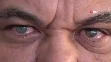 Sol gözü mavi ve kahverengi, sağ gözü yeşil