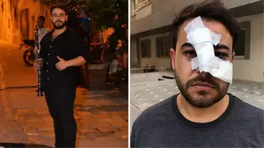 Sokak sanatçısının yüzünde şişe kırdılar! 'Biz sana mı vurduk?' diye sordular