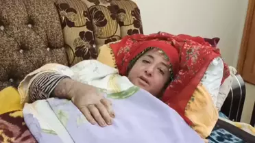 Ağır Bir Cilt Hastalığı Yüzünden Tüm Vücudu Yaralarla Kaplanan Arzu Yücel: 'Devlet Büyüklerime Sesleniyorum, Beni Kurtarsınlar'
