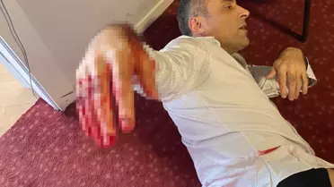 Yenilik Partisi Genel Başkanı Yılmaz, bıçaklı saldırıda yaralandı