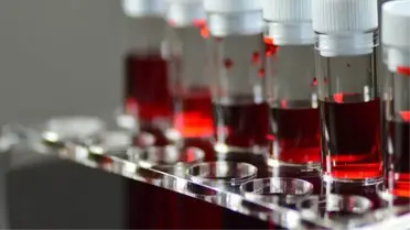 İngiltere'de yapılan kan grubu araştırmasına göre AB kan grubuna sahip kişilerin beynine pıhtı atma oranı diğer gruplara göre 5.6 kat daha fazla