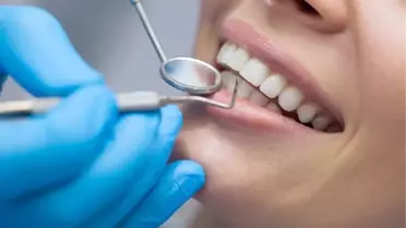 Diş Sararmasının Sebepleri ve Çözüm Yolları