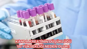 Kreatinin nedir? Kanda kreatinin düşüklüğü ve yüksekliği neden olur?