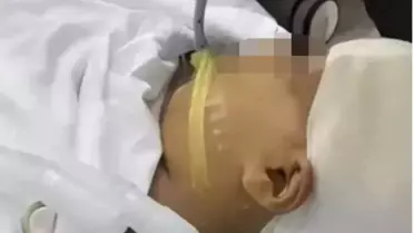 Öğretmen 9 yaşındaki öğrencisinin kafasına metal cetvelle vurarak kafatasını parçaldı