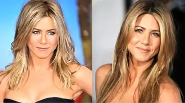 Jennifer Aniston'ın estetik işlemleri nedeniyle dizisi eleştirildi