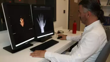 Kütahya'da Yapay Zeka Karar Destek Sistemi ile Kemik Yaşı ve Cinsiyet Belirleniyor