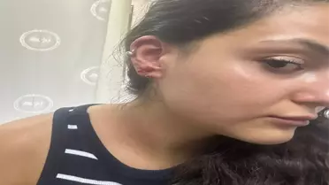 Yalova'da Muhabire Saldırı: 2 Şüpheli Gözaltına Alındı