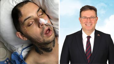 Belediye, iş kazası geçiren personelini kaderine terk etti