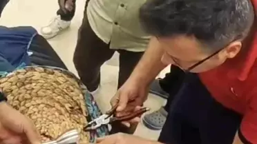 Mersin'de Kadının Parmak Sıkışması İtfaiye Ekipleri Tarafından Kurtarıldı