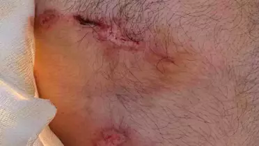 Palu'da Ayı Saldırısı: Bir Kişi Yaralandı