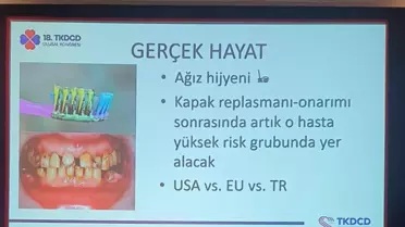 Bilimsel sunumda ortaya çıktı: 6 kişilik ailenin tamamı aynı diş fırçasını kullandı