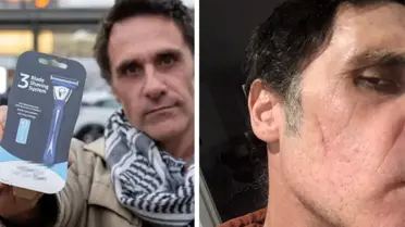 Tıraş bıçağıyla yüzünü kesen adam 213 bin lira tazminat kazandı