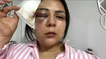 Pazarcık'ta Genç Kıza Yumruklu Saldırı