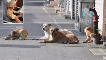Küçük çocuk, sokak köpeğinin saldırısında ölümden döndü